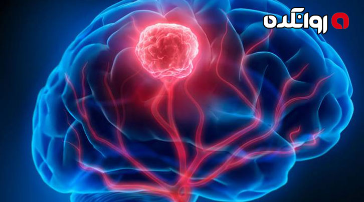 مغز شما چه‌گونه فربیتان می‌دهد؟